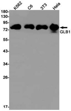 beta-Galactosidase-1/GLB1 Rabbit anti-Human, Mouse, Rat, Clone: S01-3G1, Novus Biologicals 25 &mu;g | Buy Online | Novus Biologicals | Fisher Scientific