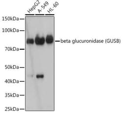 beta-Glucuronidase/GUSB Rabbit anti-Human, Clone: 4U0E2, Novus Biologicals:Antibodies:Primary