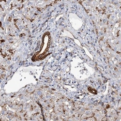beta-Glucuronidase/GUSB Antibody, Novus Biologicals 0.1mL; Unlabeled:Antibodies,