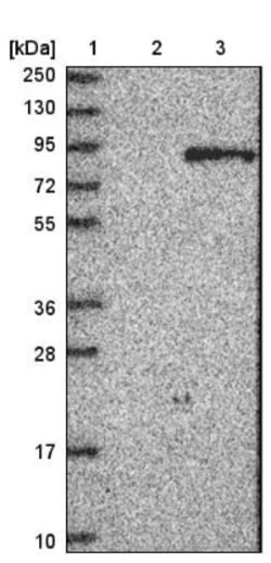 beta-Glucuronidase/GUSB Antibody, Novus Biologicals 0.1mL; Unlabeled:Antibodies,