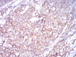 beta I Tubulin Antibody (2A1A9) - BSA Free, Novus Biologicals 0.1mg; Unlabeled:Antibodies,