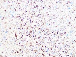 beta II Tubulin A Rabbit anti-Human, Mouse, Rat, Clone: 1R3R9, Novus Biologicals 100 &mu;g | Buy Online | Novus Biologicals | Fisher Scientific
