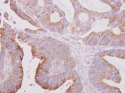 beta II Tubulin A Antibody, Novus Biologicals 0.1mL; Unlabeled:Antibodies,