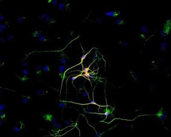beta-III Tubulin Antibody (TU-20) - BSA Free, Novus Biologicals 0.1mg;