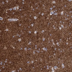beta-Synuclein Antibody, Novus Biologicals:Antibodies:Primary Antibodies