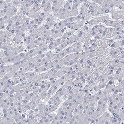 beta-Synuclein Antibody, Novus Biologicals:Antibodies:Primary Antibodies