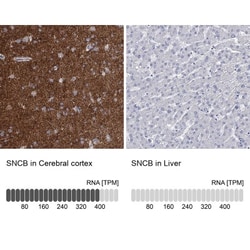beta-Synuclein Antibody, Novus Biologicals:Antibodies:Primary Antibodies