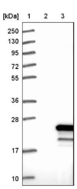 beta-Synuclein Antibody, Novus Biologicals:Antibodies:Primary Antibodies