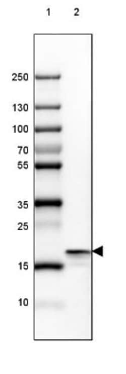 beta-Synuclein Antibody, Novus Biologicals:Antibodies:Primary Antibodies