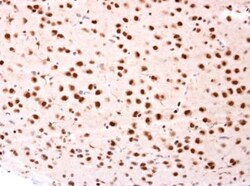 beta-TrCP1/BTRC Antibody, Novus Biologicals 0.1mg; Unlabeled:Antibodies,