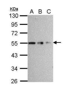 beta Tubulin Antibody, Novus Biologicals 0.1mL; Unlabeled:Antibodies, Polyclonal