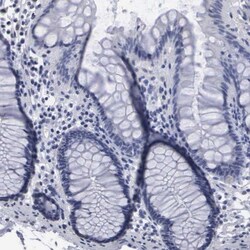 beta ureidopropionase Antibody, Novus Biologicals 0.1mL; Unlabeled:Antibodies,