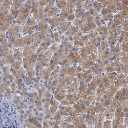 beta ureidopropionase Antibody, Novus Biologicals 0.1mL; Unlabeled:Antibodies,