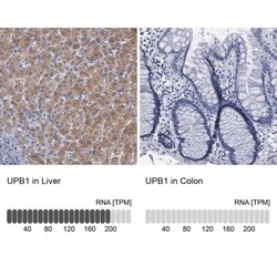 beta ureidopropionase Antibody, Novus Biologicals 0.1mL; Unlabeled:Antibodies,