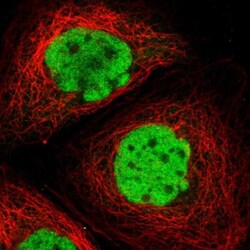 c-Fos Antibody, Novus Biologicals 0.1mL; Unlabeled:Antibodies, Polyclonal