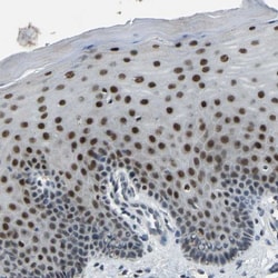 c-Fos Antibody, Novus Biologicals 0.1mL; Unlabeled:Antibodies, Polyclonal