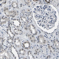 c-Fos Antibody, Novus Biologicals 0.1mL; Unlabeled:Antibodies, Polyclonal
