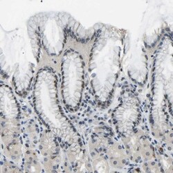 c-Fos Antibody, Novus Biologicals 0.1mL; Unlabeled:Antibodies, Polyclonal
