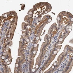 c-Myc-responsive protein Rcl Antibody, Novus Biologicals 0.1mL; Unlabeled:Antibodies,