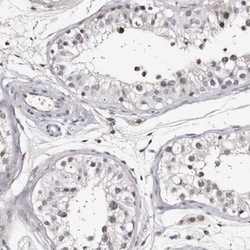 c-Myc-responsive protein Rcl Antibody, Novus Biologicals 0.1mL; Unlabeled:Antibodies,