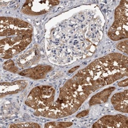 c-Myc-responsive protein Rcl Antibody, Novus Biologicals:Antibodies:Primary