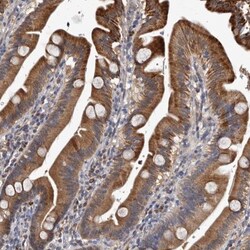 c-Myc-responsive protein Rcl Antibody, Novus Biologicals:Antibodies:Primary