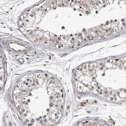 c-Myc-responsive protein Rcl Antibody, Novus Biologicals:Antibodies:Primary