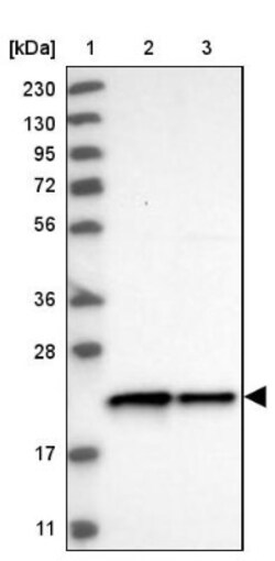 c-Myc-responsive protein Rcl Antibody, Novus Biologicals 0.1mL; Unlabeled:Antibodies,