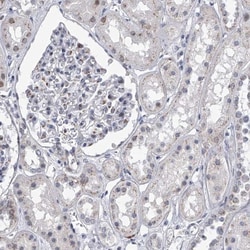 Eva-1 Homolog C Antibody, Novus Biologicals 0.1mL; Unlabeled:Antibodies,
