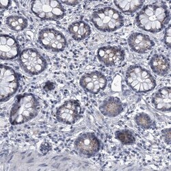 Eva-1 Homolog C Antibody, Novus Biologicals 0.1mL; Unlabeled:Antibodies,
