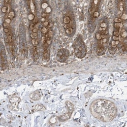cGAS Antibody, Novus Biologicals 0.1mL; Unlabeled:Antibodies, Polyclonal
