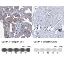 carboxylesterase 4A Antibody, Novus Biologicals 0.1mL; Unlabeled:Antibodies,