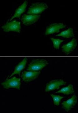 cleavage stimulation factor Antibody (10E11) - BSA Free, Novus Biologicals