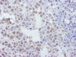 cleavage stimulation factor Antibody, Novus Biologicals 100 &mu;L | Buy Online | Novus Biologicals | Fisher Scientific