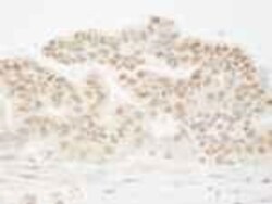 cleavage stimulation factor Antibody, Novus Biologicals 100 &mu;L | Buy Online | Novus Biologicals | Fisher Scientific