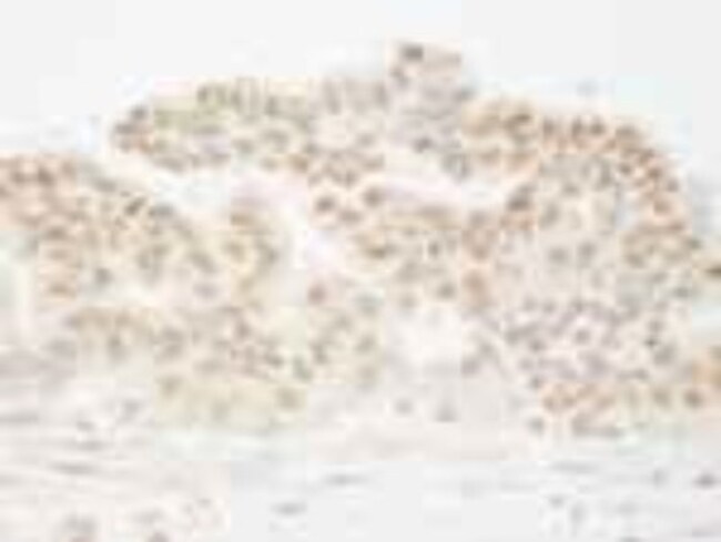 cleavage stimulation factor Antibody 0.1mg; UnlabeledAntibodies