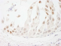 cleavage stimulation factor Antibody, Novus Biologicals 100 &mu;L | Buy Online | Novus Biologicals | Fisher Scientific