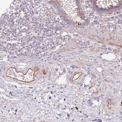 cyclin-I2 Antibody, Novus Biologicals 0.1mL; Unlabeled:Antibodies, Polyclonal