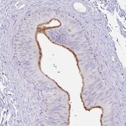 cystatin 11 Antibody, Novus Biologicals 25 &mu;L, Unlabeled:Antibodies,