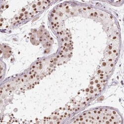 cysteine/histidine-rich 1 Antibody, Novus Biologicals 0.1mL; Unlabeled:Antibodies,