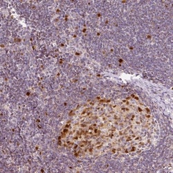 dUTPase Antibody, Novus Biologicals 25 &mu;L | Buy Online | Novus Biologicals | Fisher Scientific