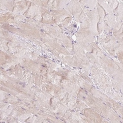 dUTPase Antibody, Novus Biologicals 25 &mu;L | Buy Online | Novus Biologicals | Fisher Scientific