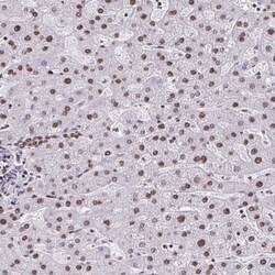 dUTPase Antibody, Novus Biologicals 0.1mL; Unlabeled:Antibodies, Polyclonal