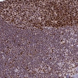 dUTPase Antibody, Novus Biologicals 0.1mL; Unlabeled:Antibodies, Polyclonal