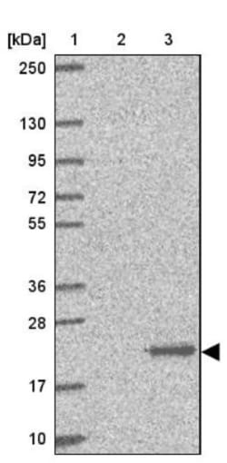 dUTPase Antibody, Novus Biologicals 25 &mu;L | Buy Online | Novus Biologicals | Fisher Scientific