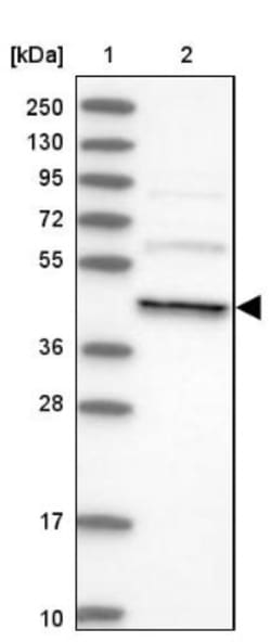 dynactin 4 Antibody, Novus Biologicals:Antibodies:Primary Antibodies