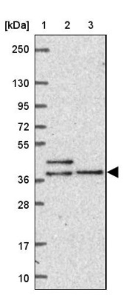 dynein, cytoplasmic 2, light intermediate chain 1 Antibody, Novus Biologicals:Antibodies:Primary