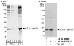 eIF3K Antibody, Novus Biologicals 0.1mL; Unlabeled:Antibodies, Polyclonal