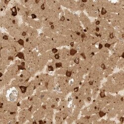 eIF4GII Antibody, Novus Biologicals 25 &mu;L; Unlabeled:Antibodies, Polyclonal