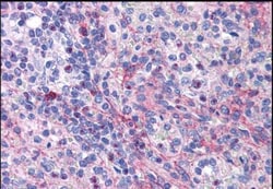 eIF5A Antibody, Novus Biologicals 0.1mg; Unlabeled:Antibodies, Polyclonal